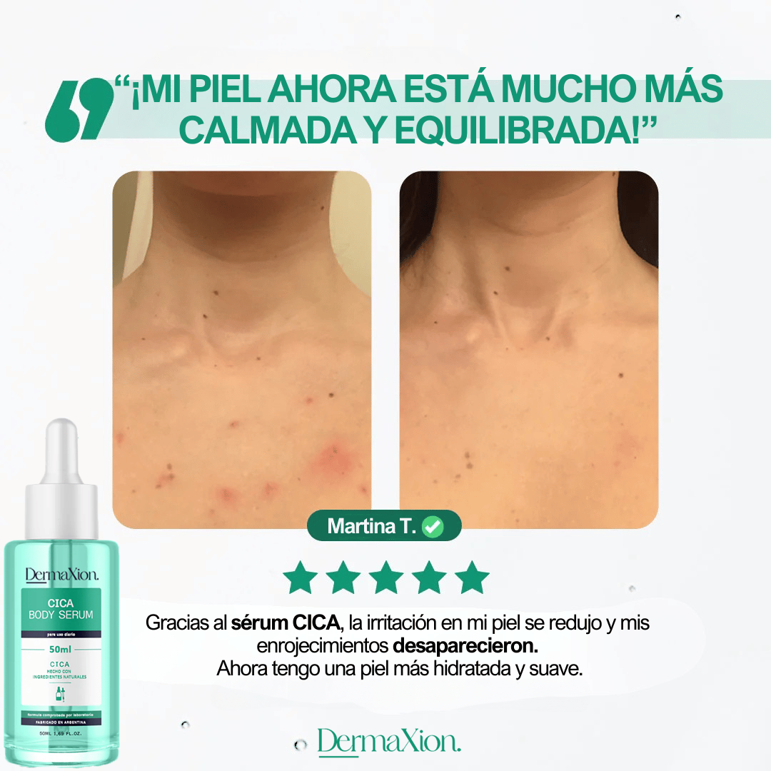 DermaXion: Cica Serum antiacné