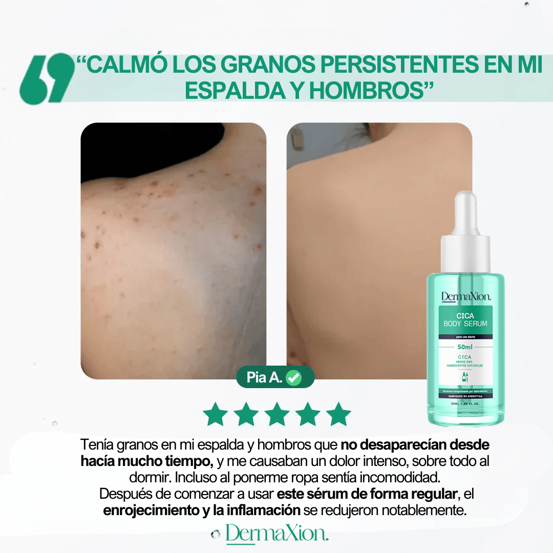 DermaXion: Cica Serum antiacné