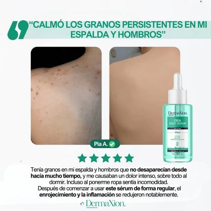 DermaXion: Cica Serum antiacné